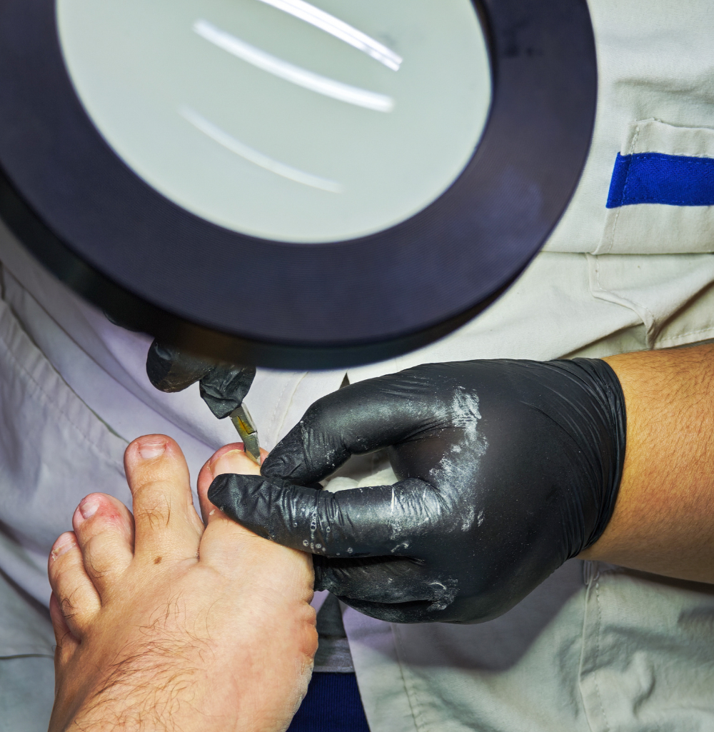 ongle podologue tubize