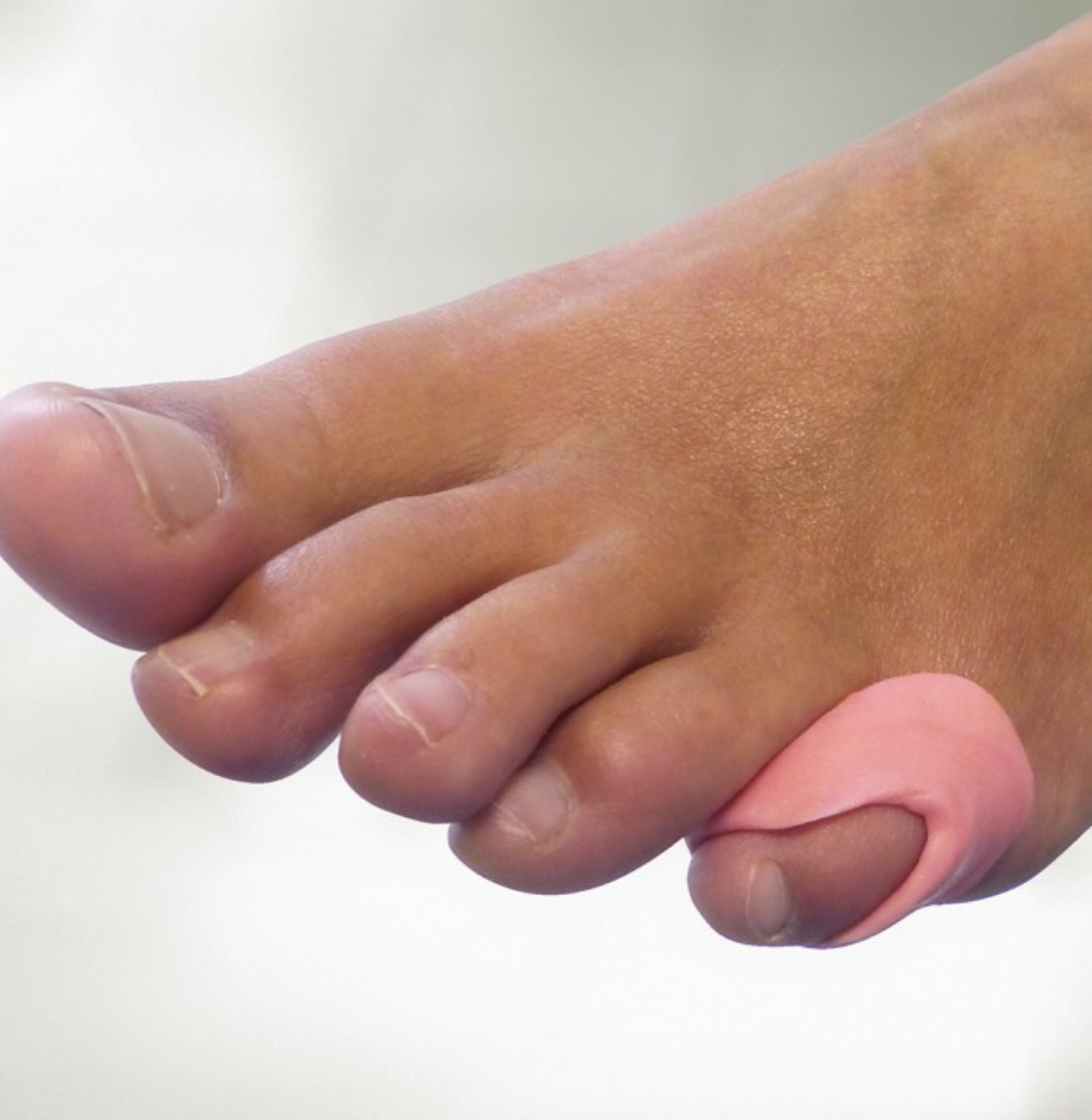 Orthoplastie silicone orteils podologue